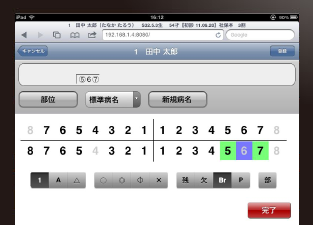 iPadで部位入力をしている画面