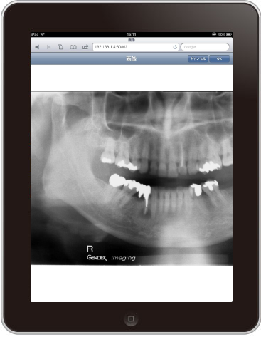 iPadのX線画像をプレゼンテーションしている画面