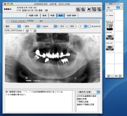 X線写真の表示、登録の画面