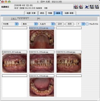 口腔内写真の表示、登録の画面